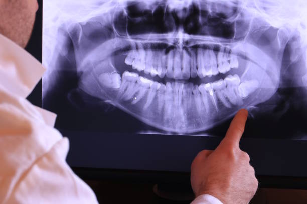 Best Broken or Cracked Tooth Emergency Dentist in Magnolia, OH