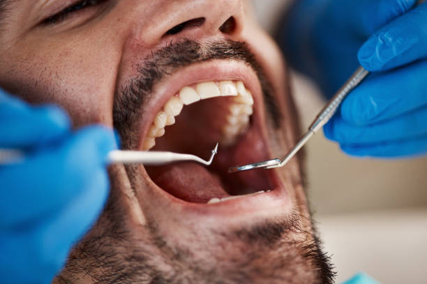 Best Holiday Emergency Dentist in Magnolia, OH